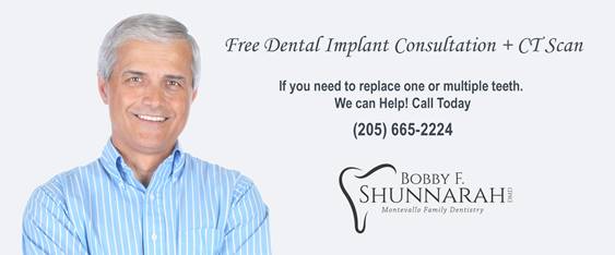Free Dental Implant Consultation + CT Scan