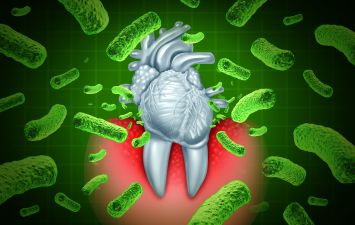 gum disease heart issues